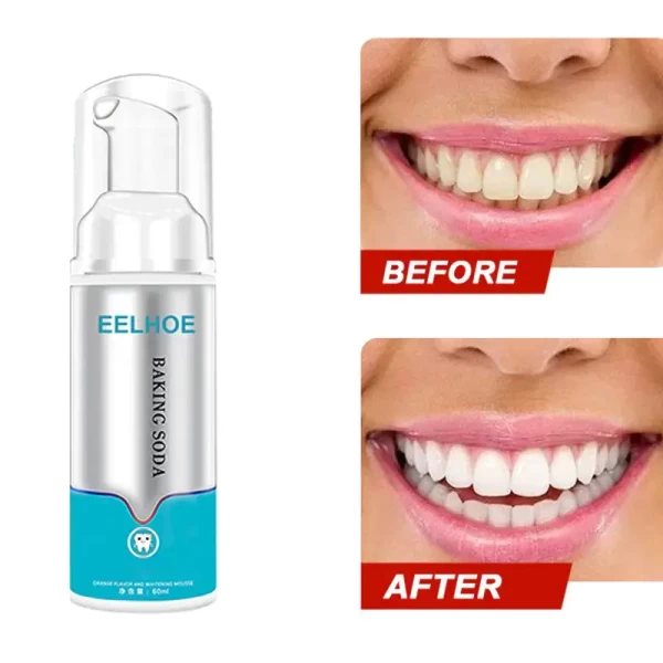 Eelhoe Baking Soda - Deep Cleaning Foam Toothpaste
