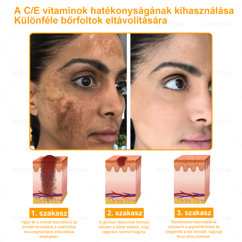 Honey Firming Cream supports rapid skin