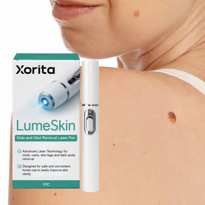 Electric Laser Plasma Pen Mole Removal Dark Spot Remover Skin Wart Tag Remover